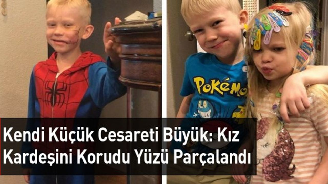 Küçük Kahraman, Kız Kardeşini Köpek Saldırısından Kurtardı: Yüzü Parçalandı