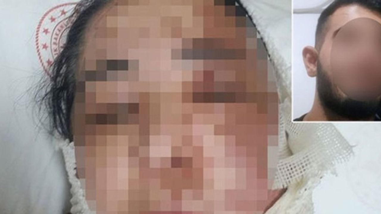 Üvey annesinin üzerine kezzap atan şüpheli aranıyor!