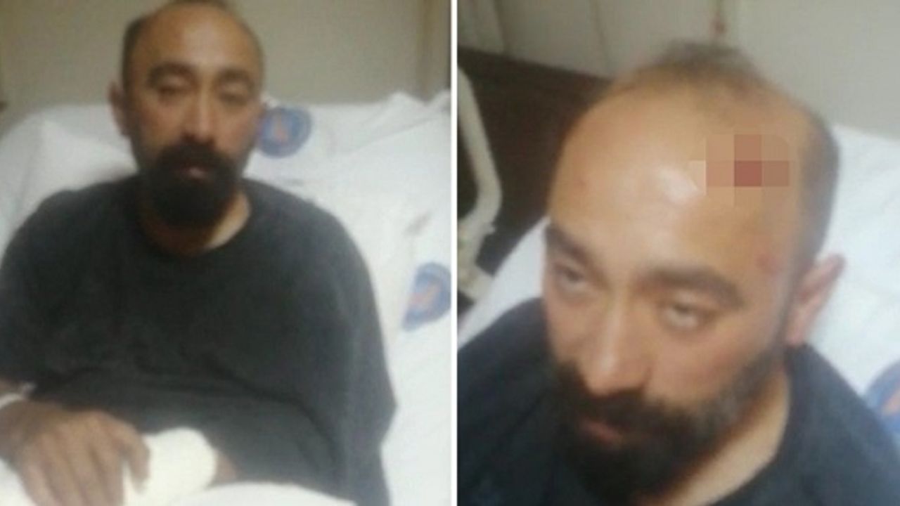Başına Parke Taşıyla Vurulan Taksici Ağır Yaralandı