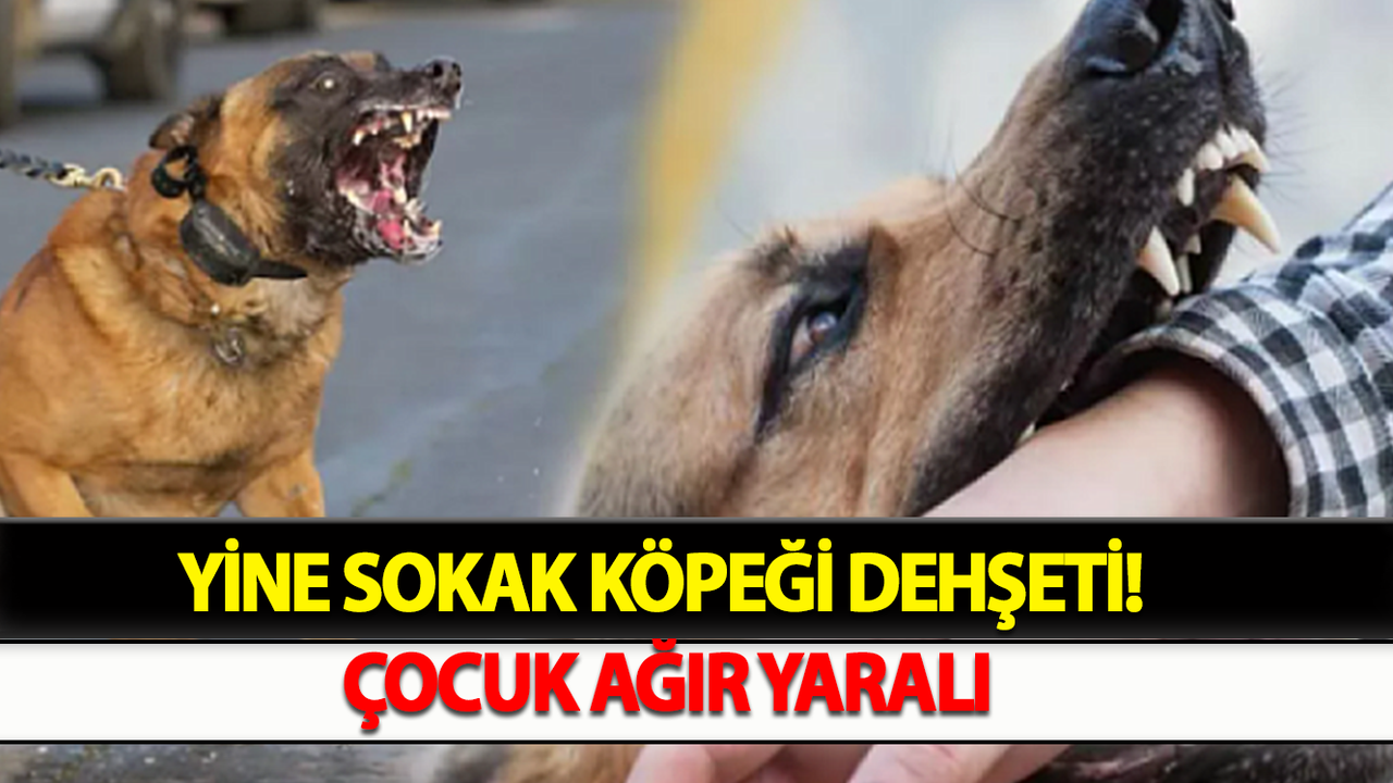 Yine sokak köpeği dehşeti! Çocuk Ağır Yaralı