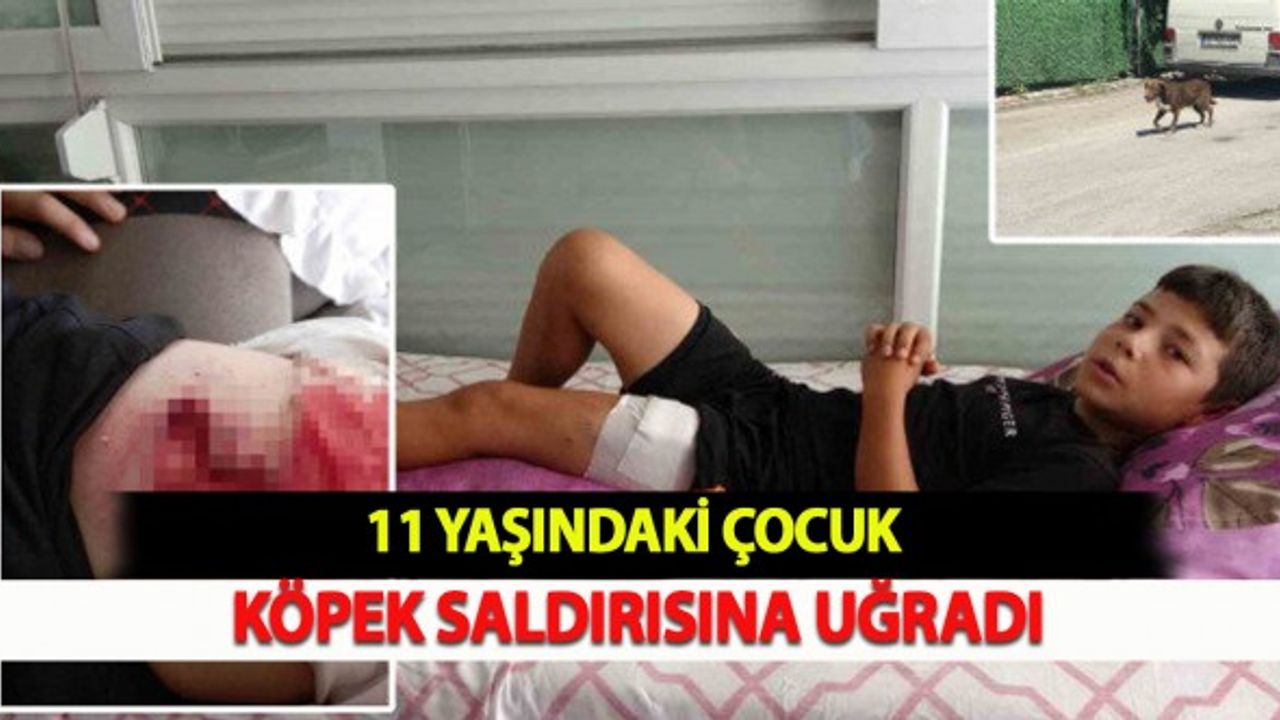 11 Yaşındaki Çocuk Köpek Saldırısına Uğradı