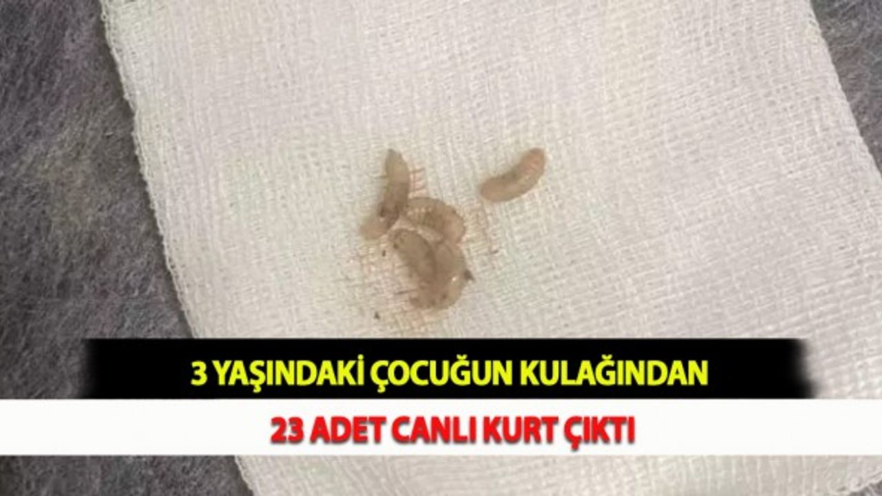 3 Yaşındaki Çocuğun Kulağından 23 Adet Canlı Kurt Çıktı