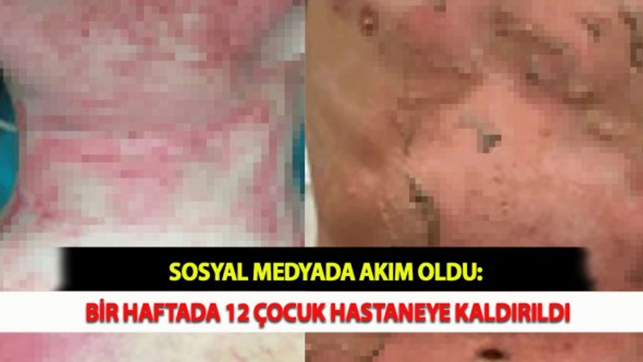 Sosyal Medyada Akım Oldu: Bir Haftada 12 Çocuk Hastaneye Kaldırıldı