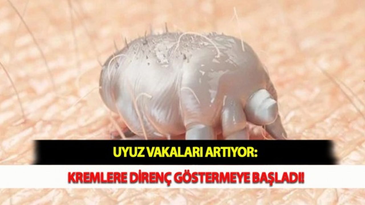 Uyuz Vakaları Artıyor: Kremlere Direnç Göstermeye Başladı!