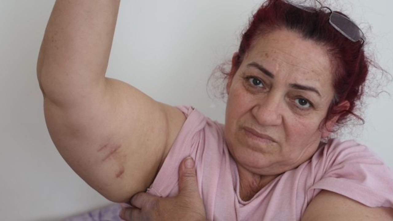 Köpeklerin saldırısına uğrayan kadın: “Ben o an öldüğümü sandım”