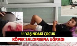 11 Yaşındaki Çocuk Köpek Saldırısına Uğradı