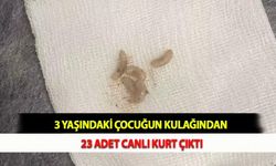 3 Yaşındaki Çocuğun Kulağından 23 Adet Canlı Kurt Çıktı