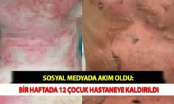 Sosyal Medyada Akım Oldu: Bir Haftada 12 Çocuk Hastaneye Kaldırıldı
