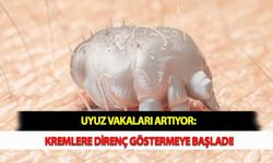 Uyuz Vakaları Artıyor: Kremlere Direnç Göstermeye Başladı!