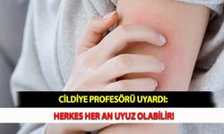 Cildiye Profesörü Uyardı: Herkes Her An Uyuz Olabilir!