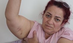 Köpeklerin saldırısına uğrayan kadın: “Ben o an öldüğümü sandım”