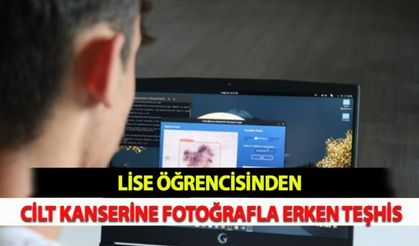 Lise Öğrencisinden;  Cilt Kanserine Fotoğrafla Erken Teşhis